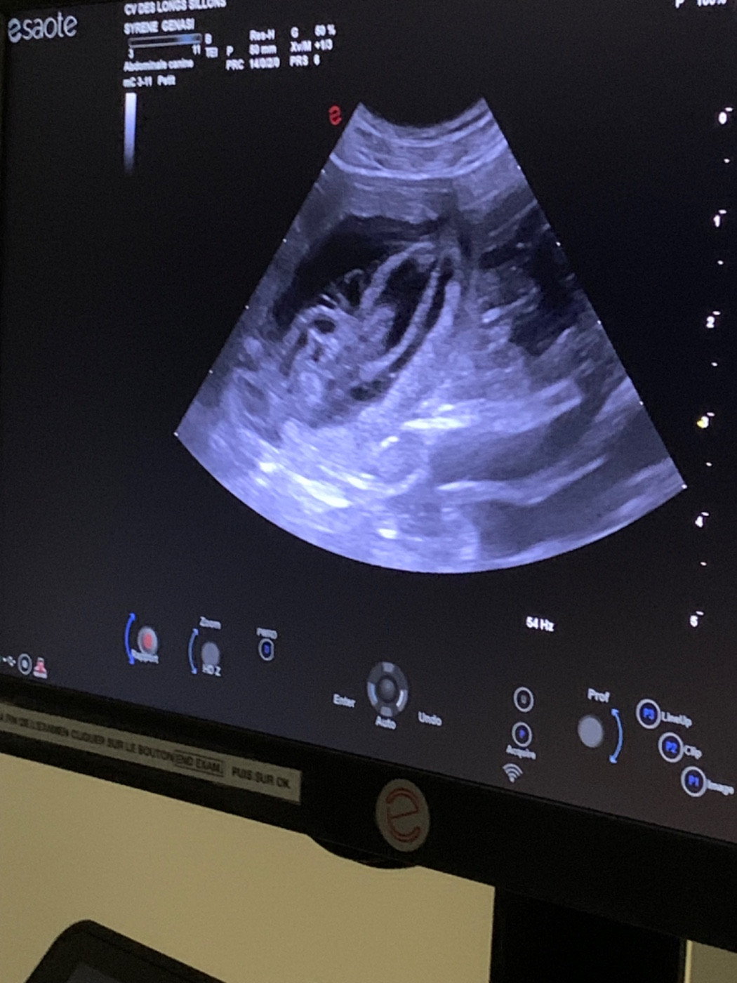 Les futurs canons de beauté et de chasse de Syrene arriveront début avril !!